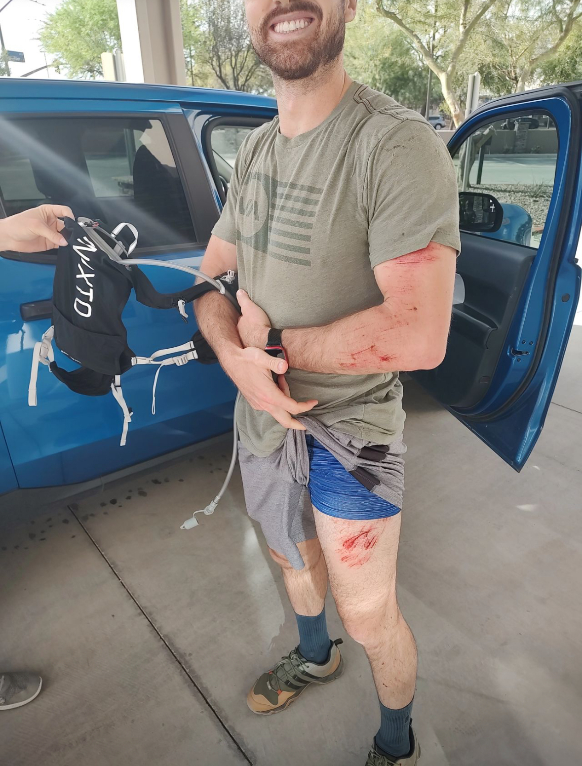 Zack's mountain bike crash Zack's mountain bike crash