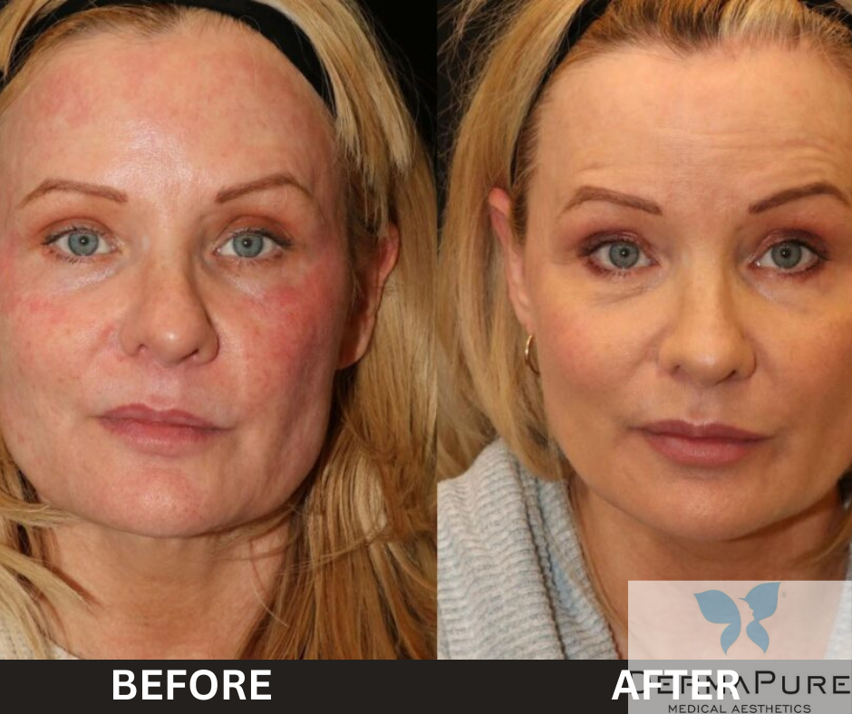 Before and After Image