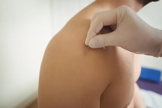 Austin physical therapy  Physical therapist Austin TX  Manual therapy Austin  Dry needling Austin  Sports physical therapy Austin  Out-of-network physical therapy Austin  Private physical therapy Austin  Cash-based physical therapy Austin  Performance physical therapy Austin  Holistic physical therapy Austin