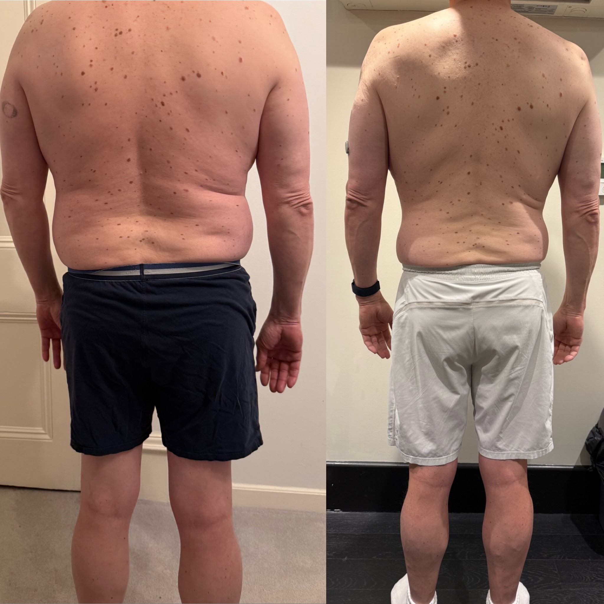 Imagen de transformación