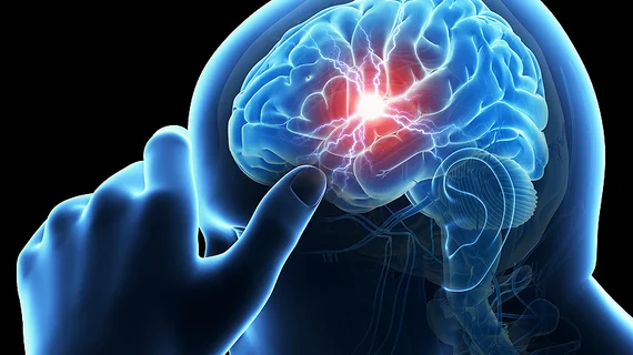 Stroke Stroke