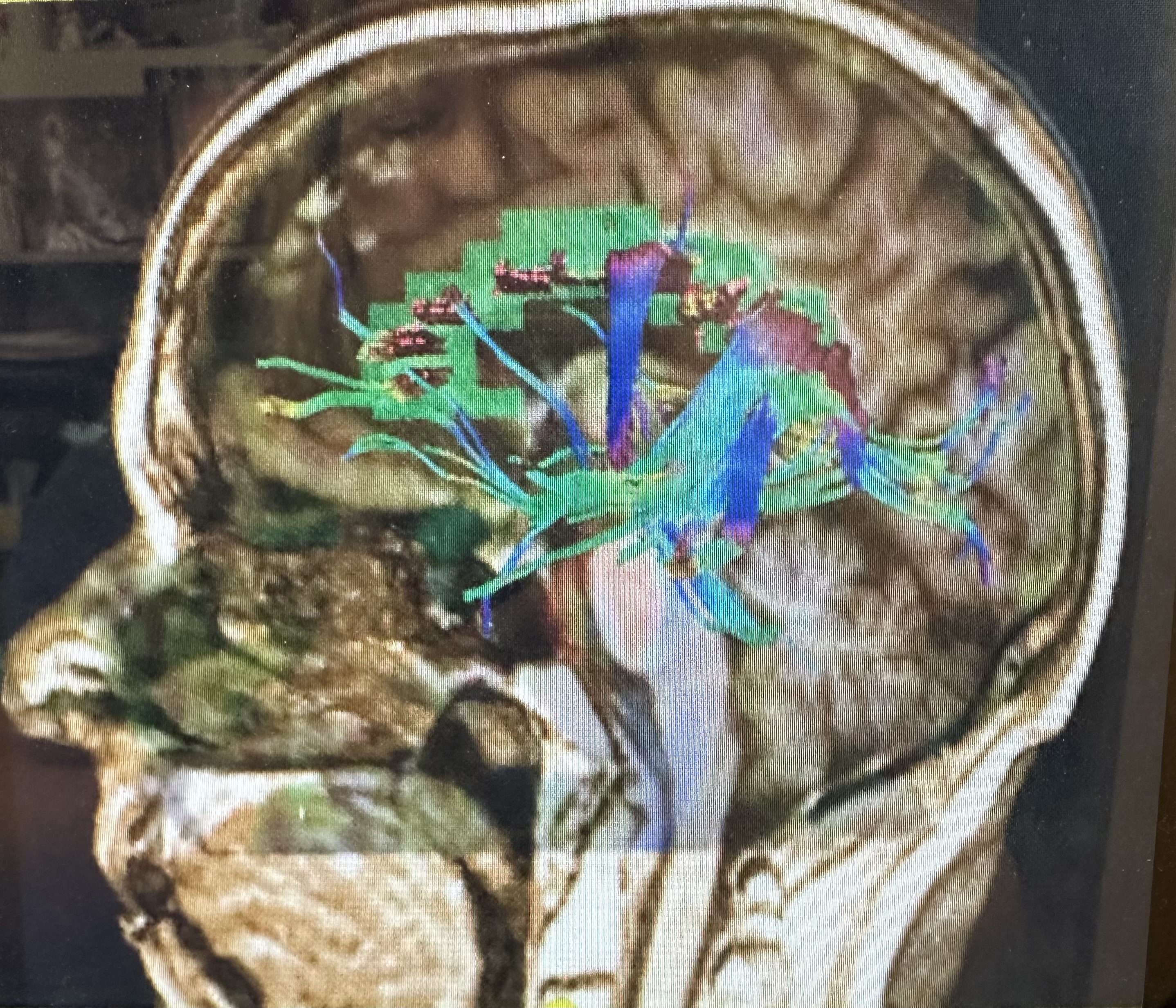 Brain Brain
