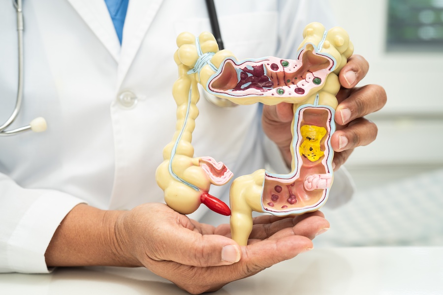 natural alternatives to GLP-1 drugs natural alternatives to GLP-1 drugs