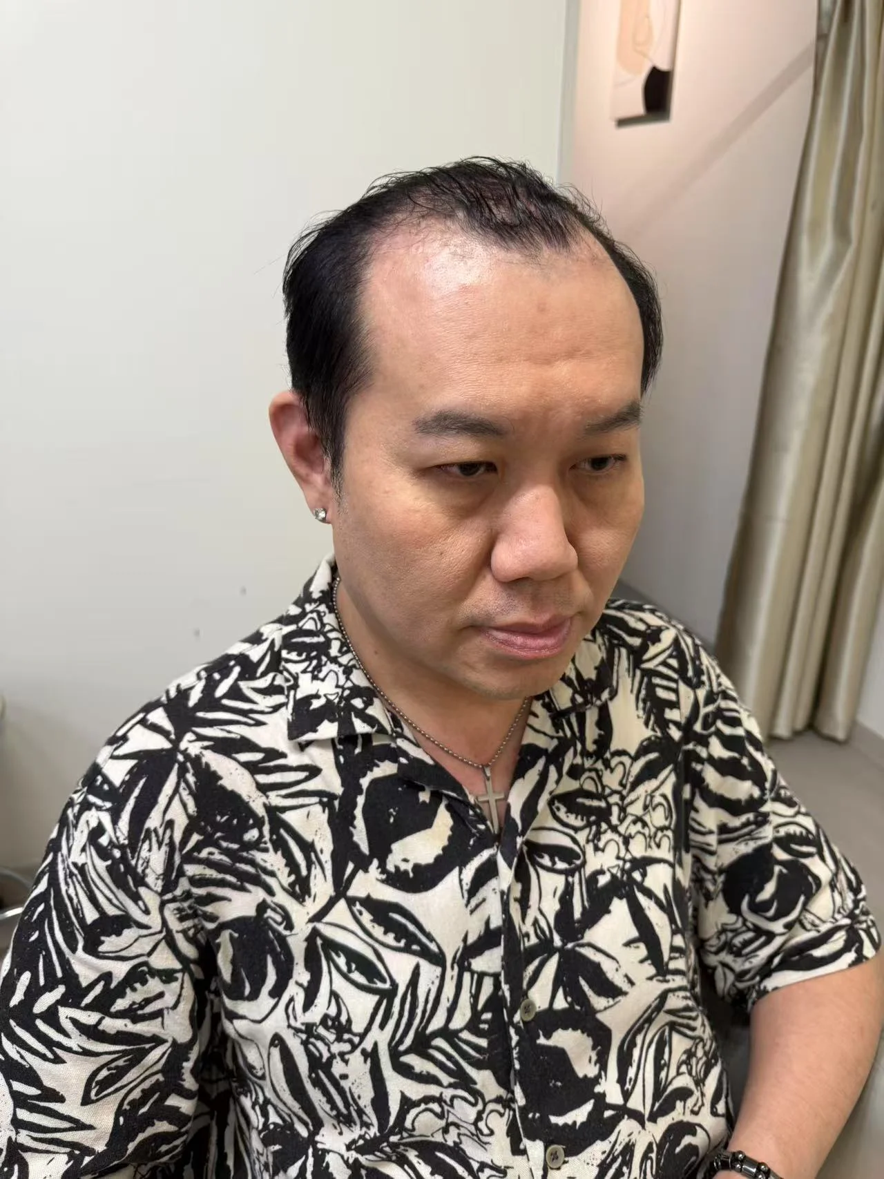 Before Hairwig