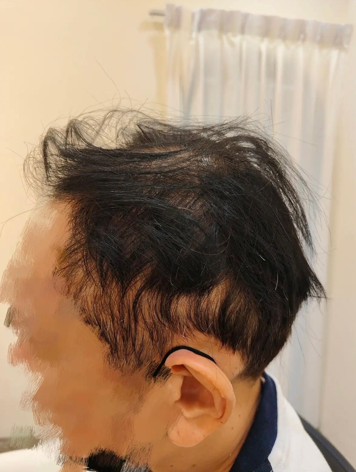 before hair wig 