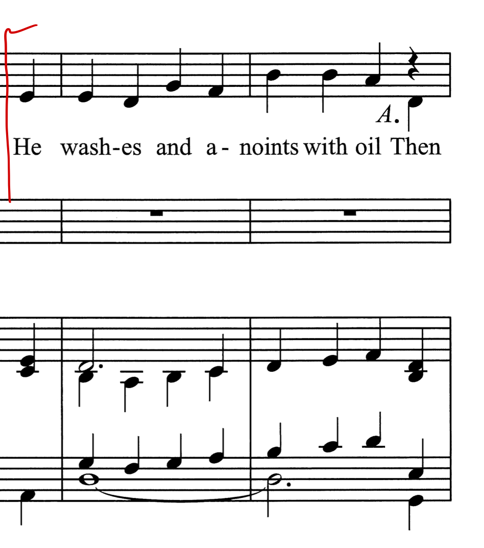 Behold the Wounds - Example 4 Behold the Wounds - Example 4
