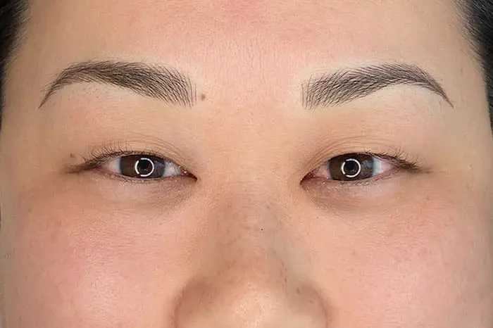 After microblading transformation showing natural hair-stroke brows – Los Angeles area