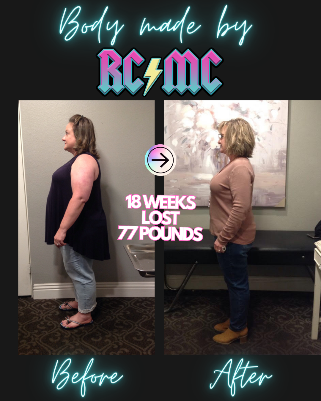 RCMC patient before and after 11