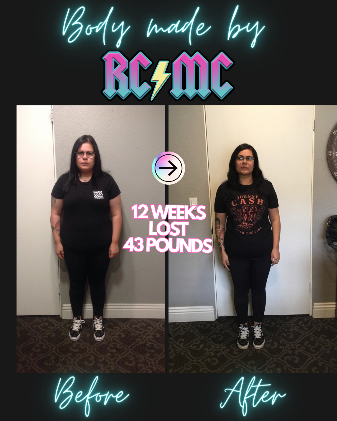 RCMC patient before and after 15
