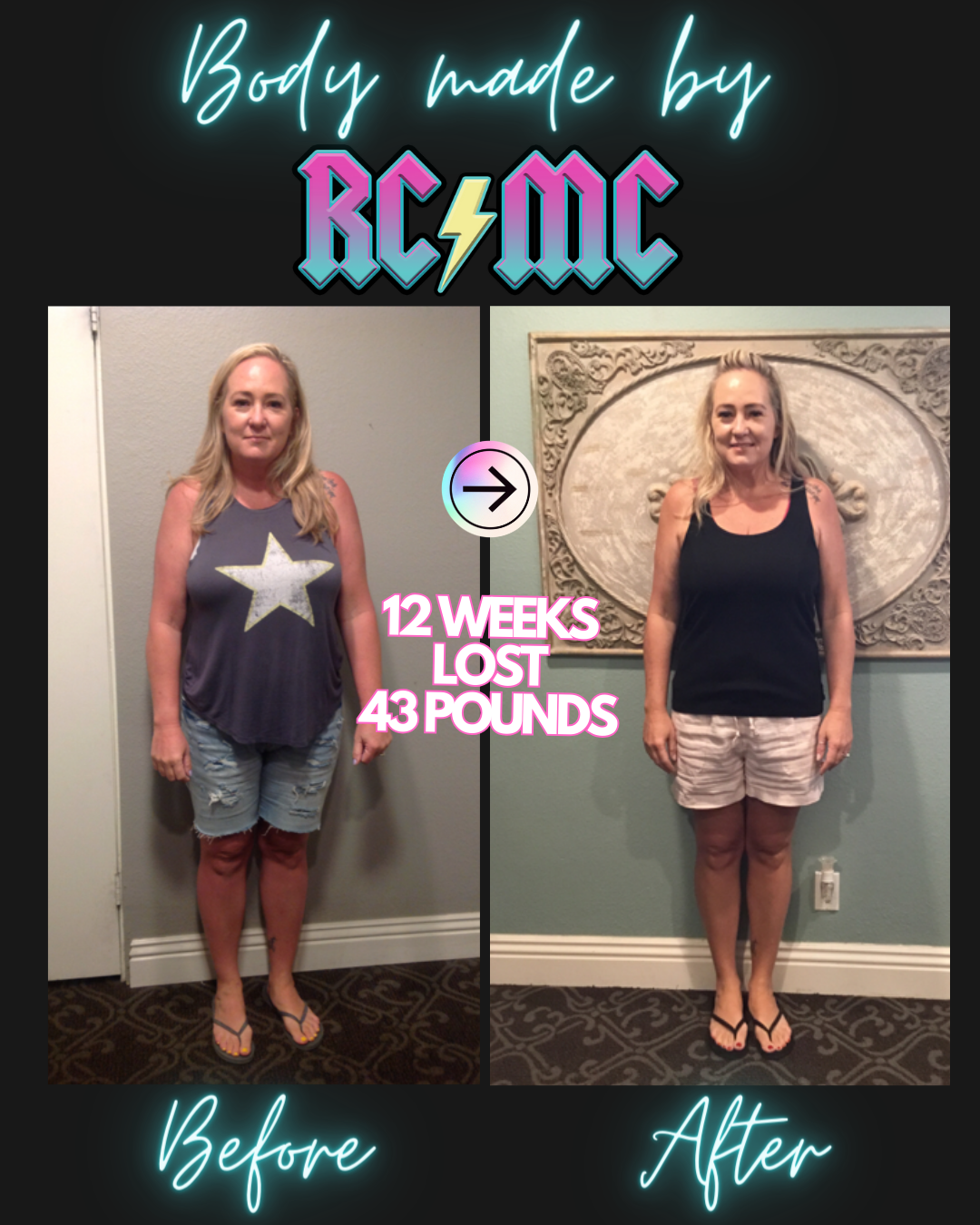 RCMC patient before and after 16