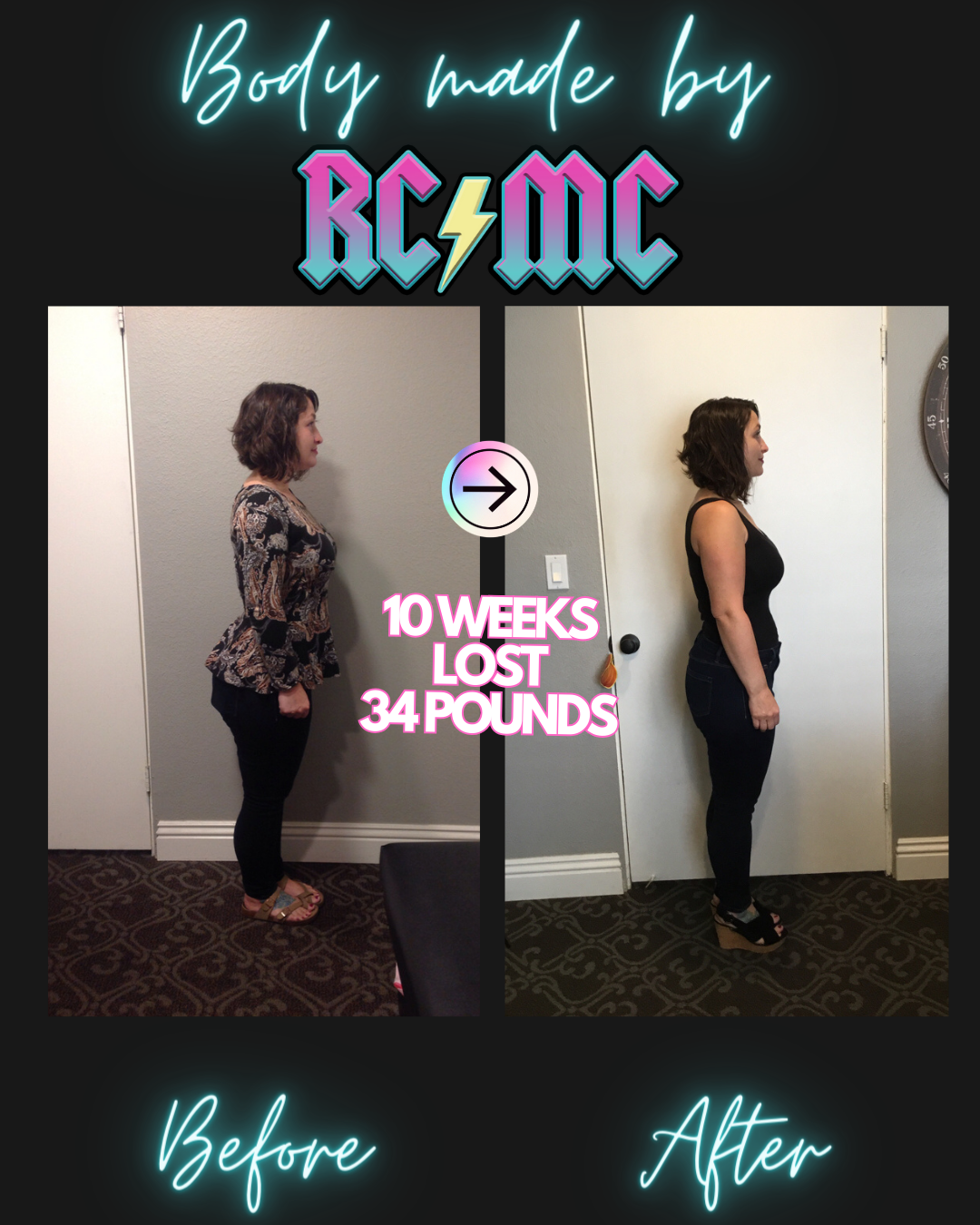 RCMC patient before and after 20