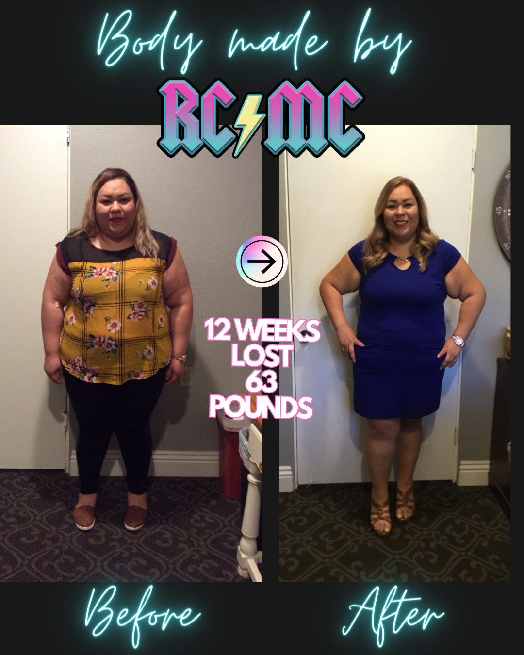 RCMC patient before and after 14