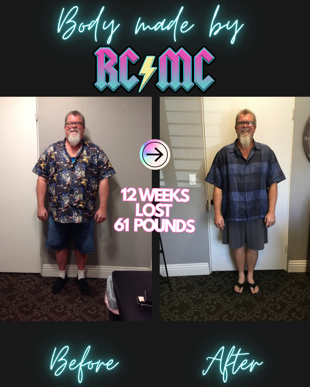RCMC patient before and after 4