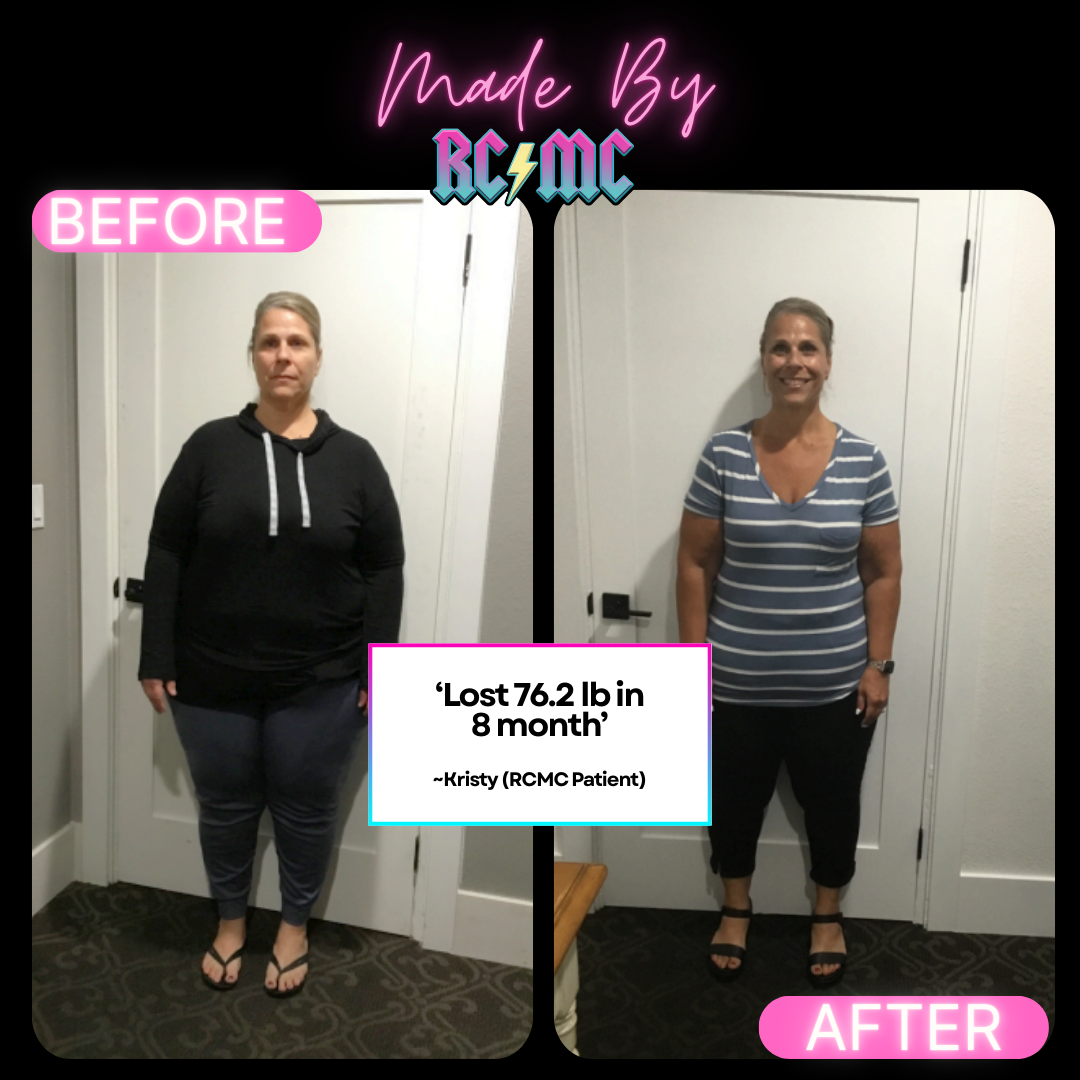 RCMC patient before and after 2