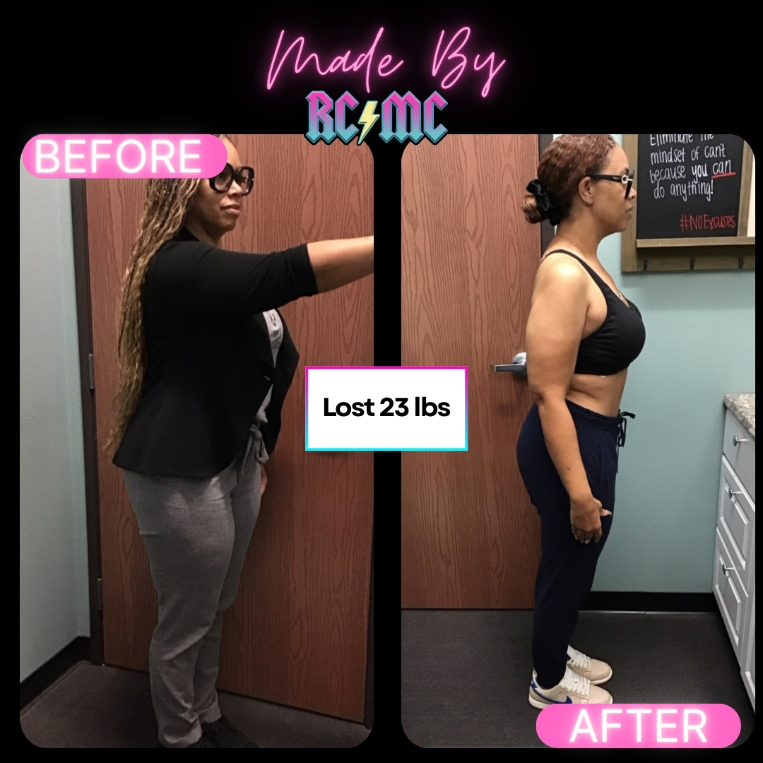 RCMC patient before and after 3
