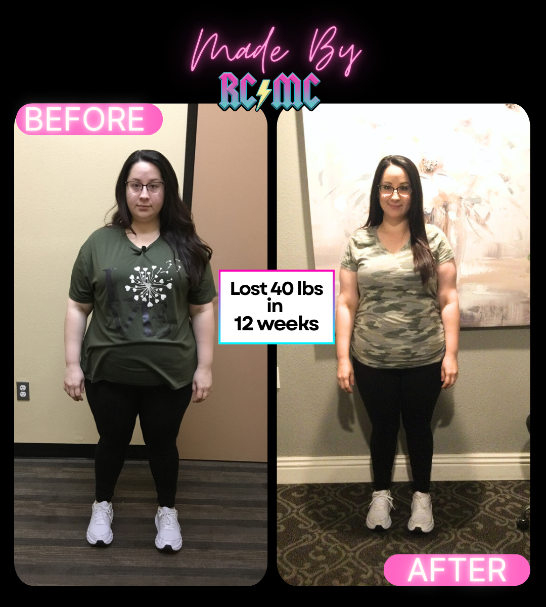 RCMC patient before and after 7