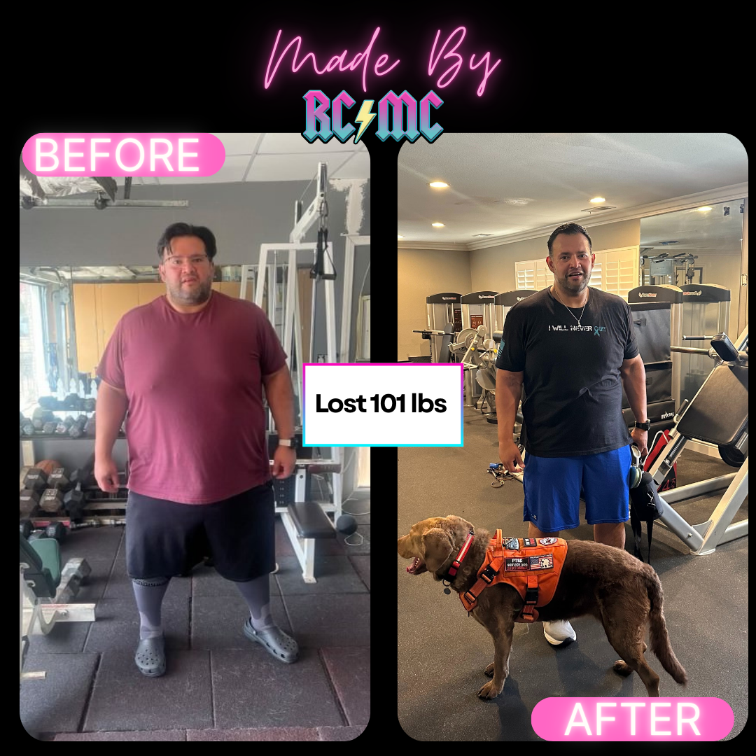 RCMC patient before and after 8