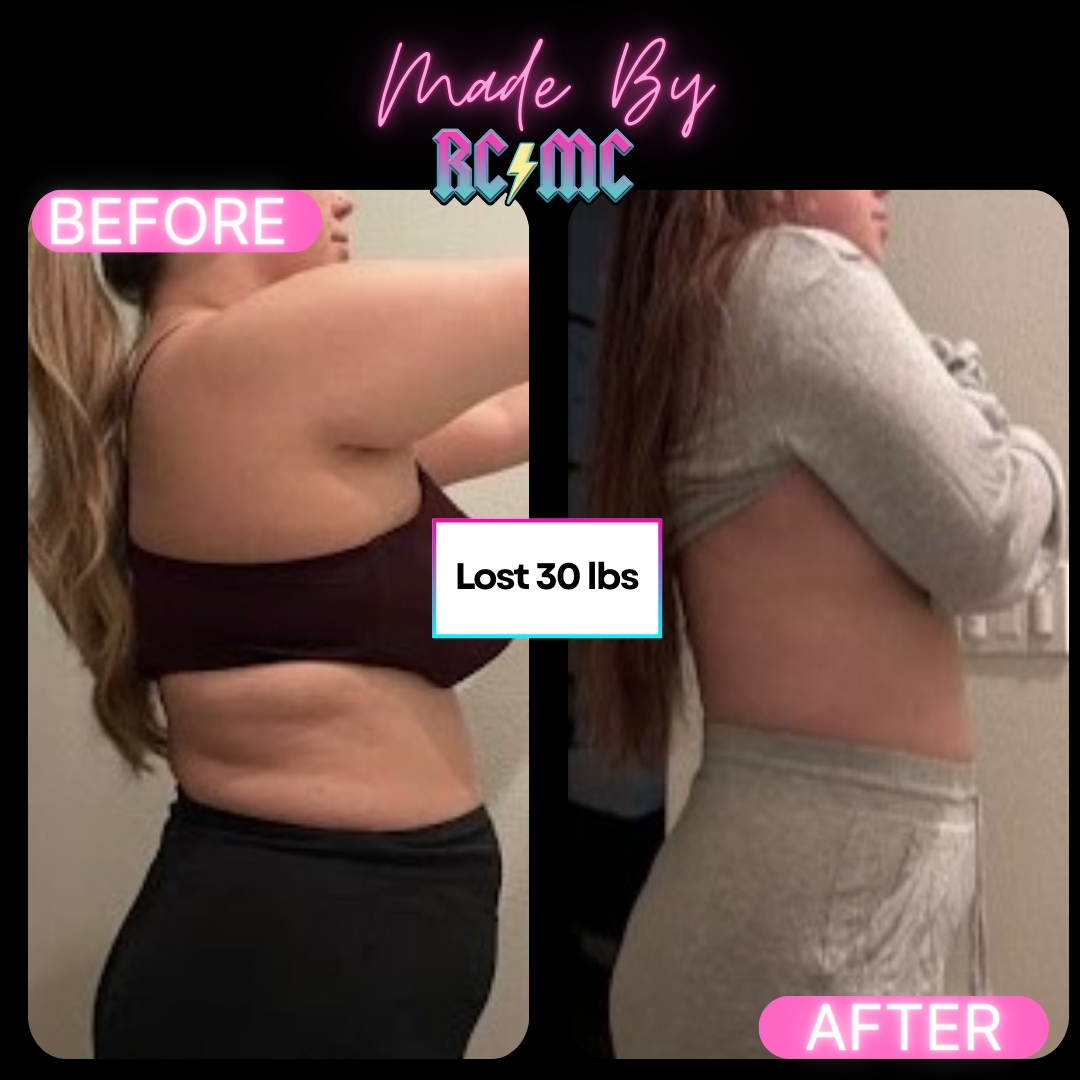 RCMC patient before and after 18
