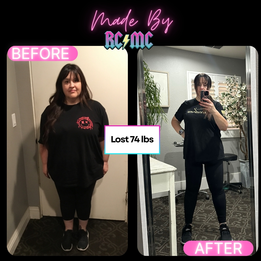 RCMC patient before and after 9