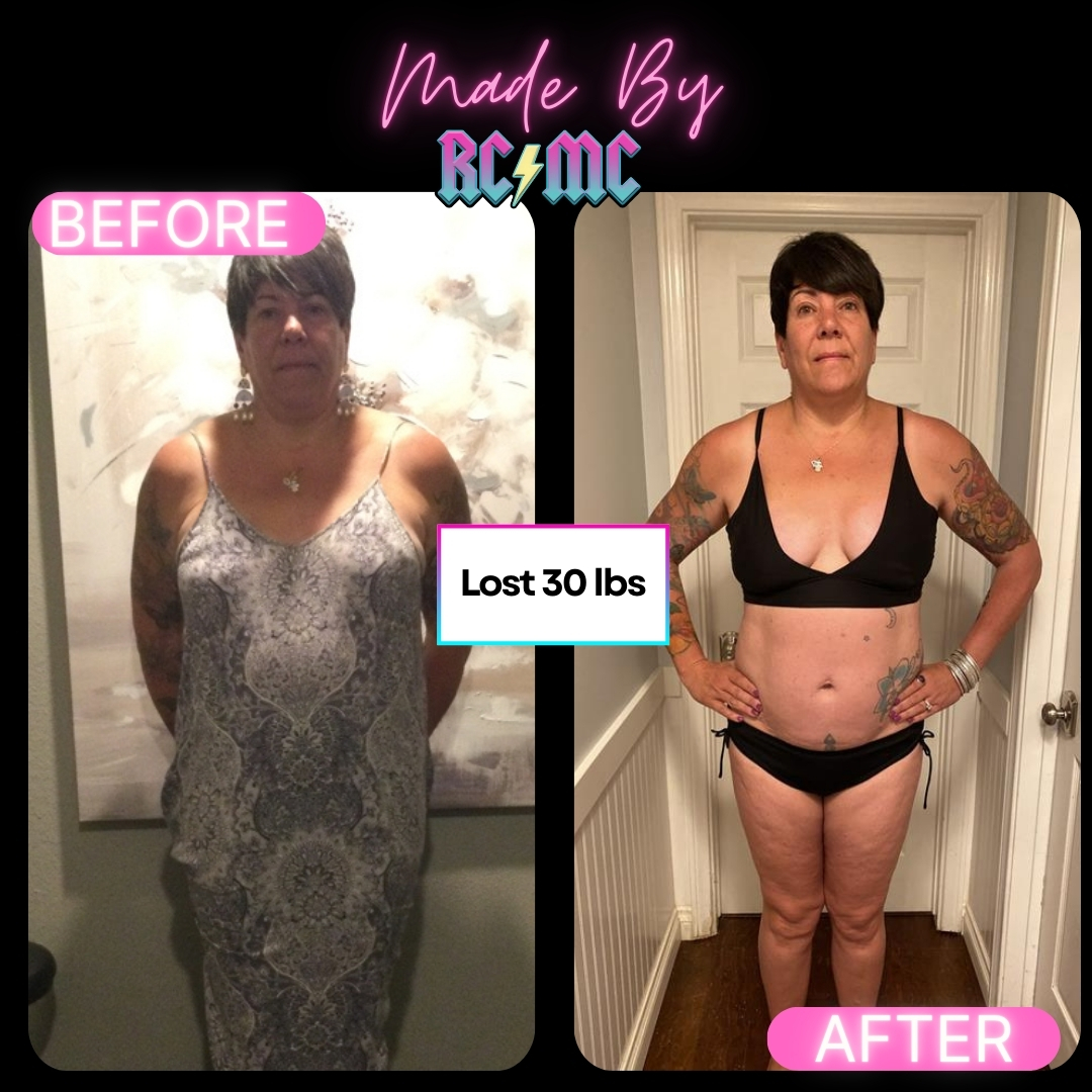 RCMC patient transformation