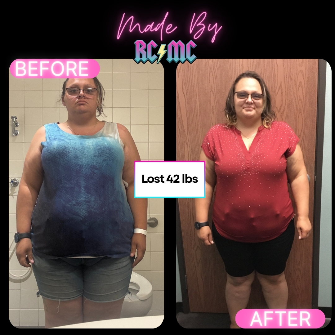 RCMC patient transformation