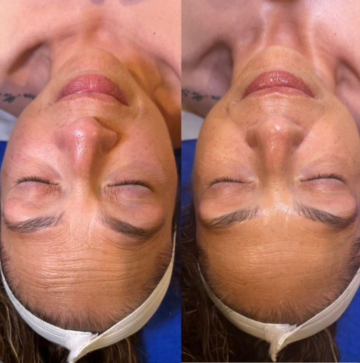 Feature of The Skin Retreat’s ‘Retreat Facial’ service with skincare details and a calm spa aesthetic to highlight relaxation Feature of The Skin Retreat’s ‘Retreat Facial’ service with skincare details and a calm spa aesthetic to highlight relaxation