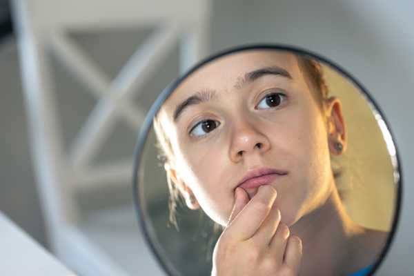 Body Dysmorphic Disorder