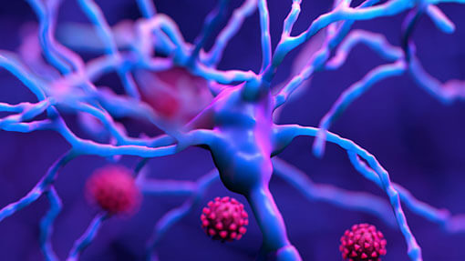 What is inflammation What is inflammation