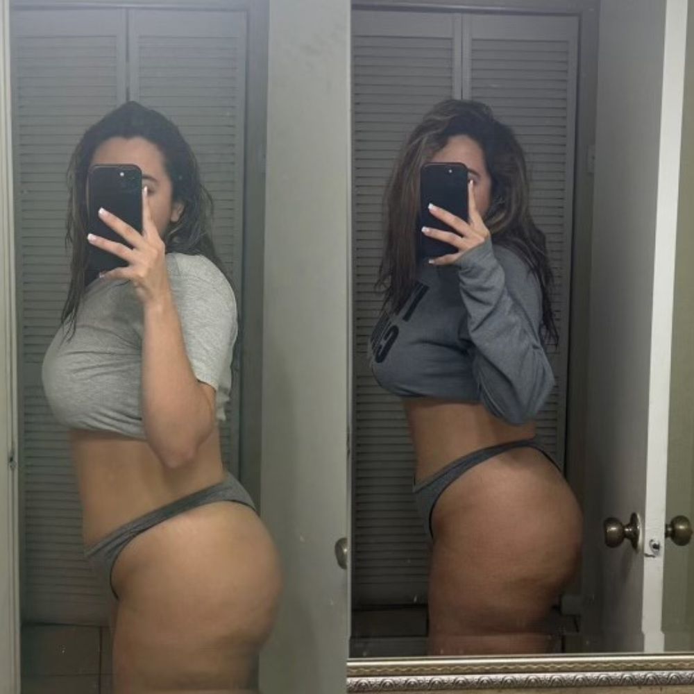 Weight Loss Transformation