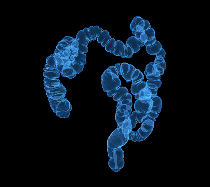 Virtual Colonoscopy: High Quality Colorectal Cancer Screenings