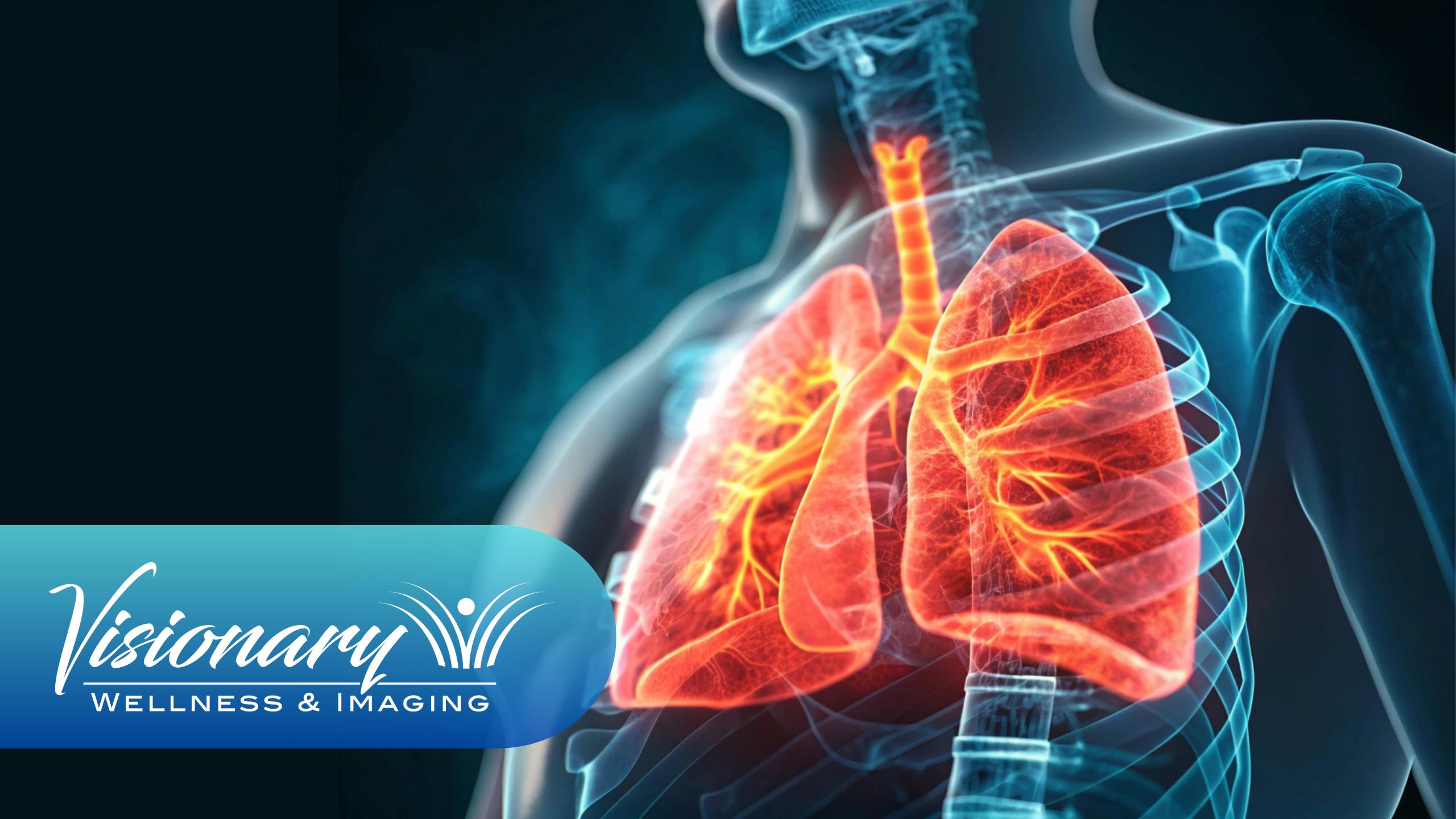 Understanding Lung Cancer Stages: The Vital Role of Early Detection with Heart & Lung Scans