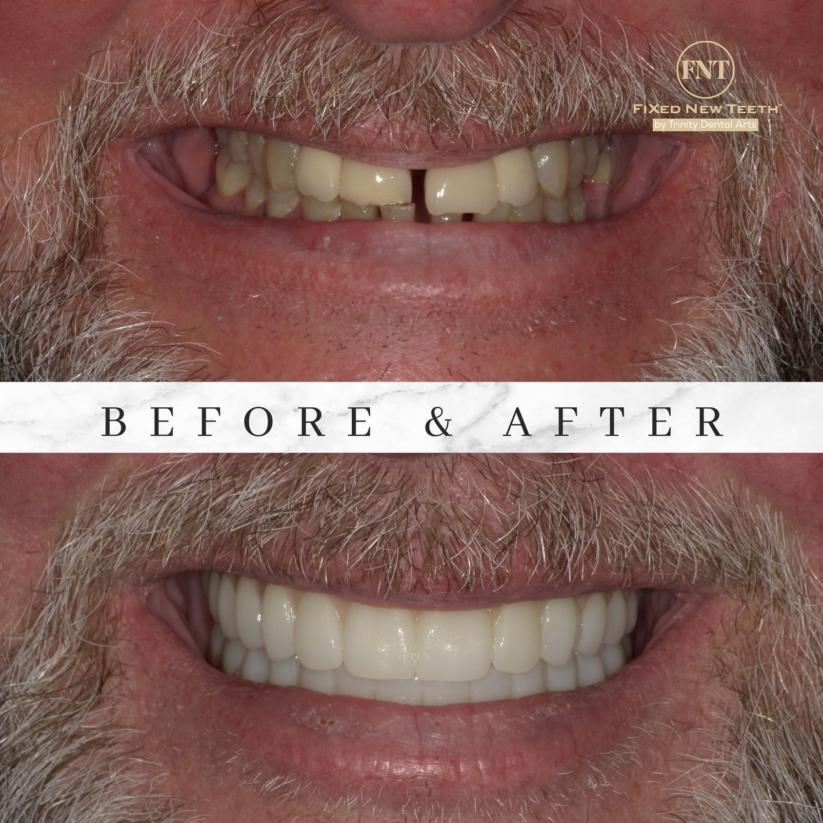 Patient result 1