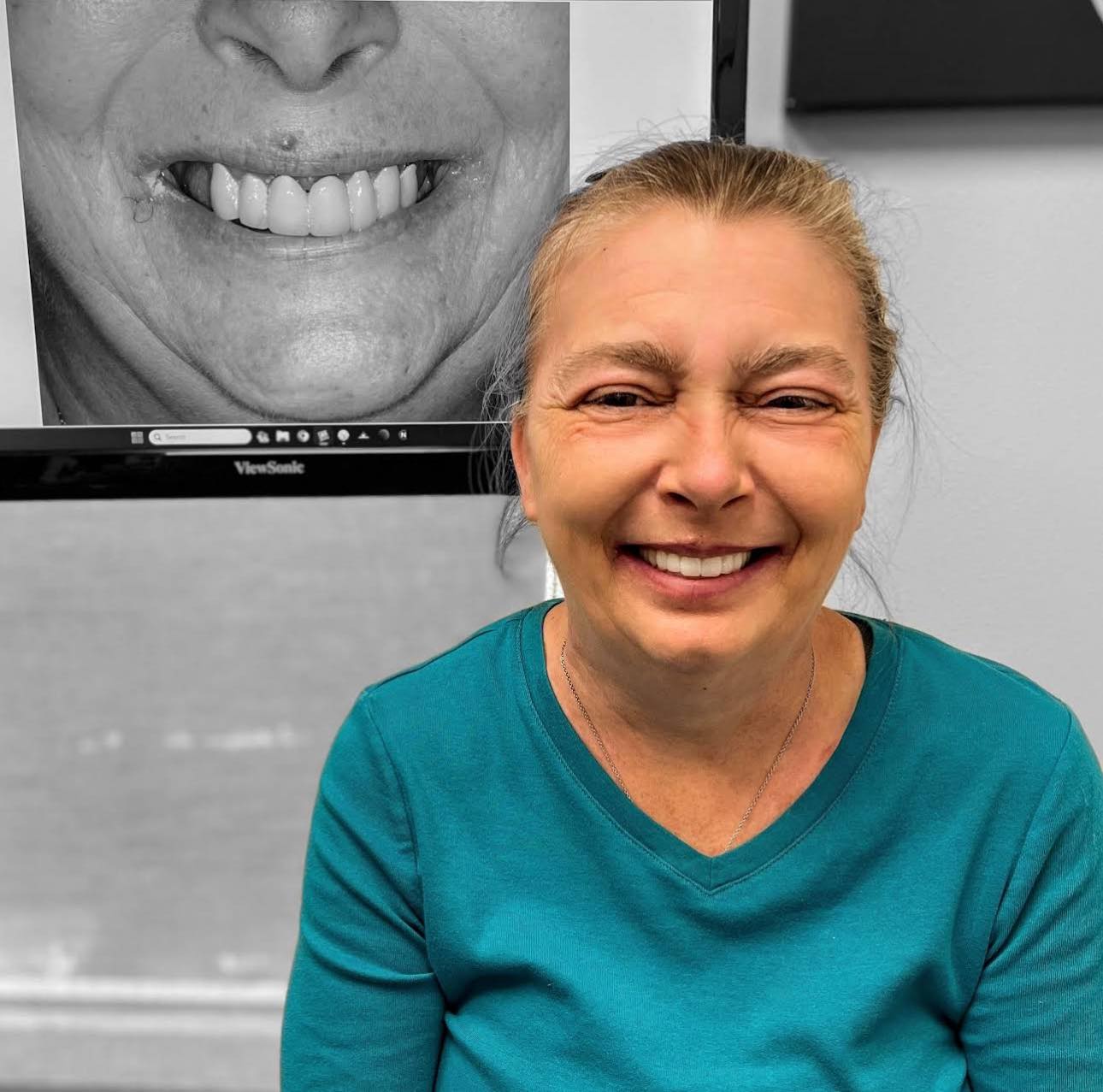 Patient result 10