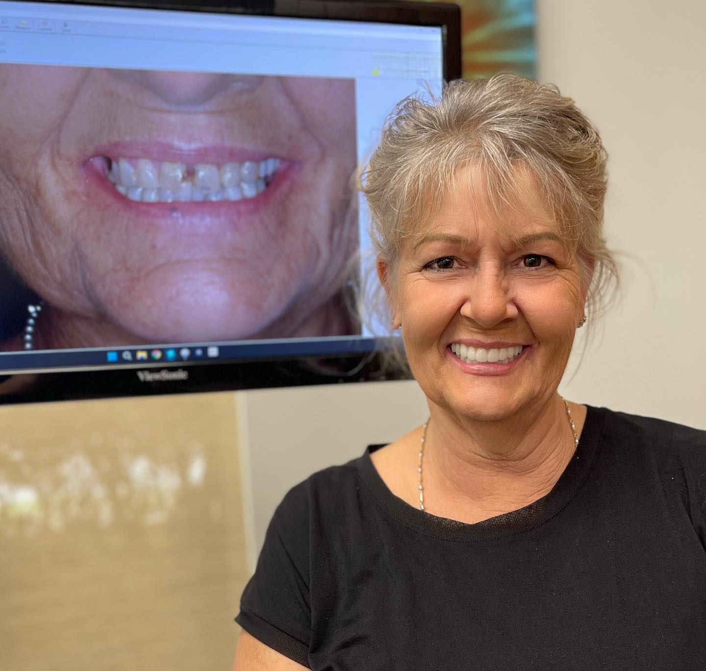 Patient result 9