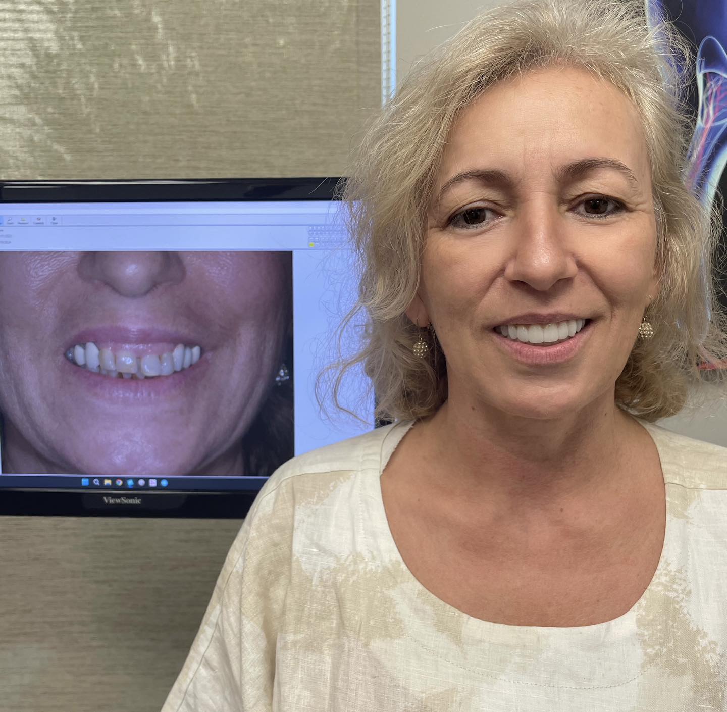 Patient result 5