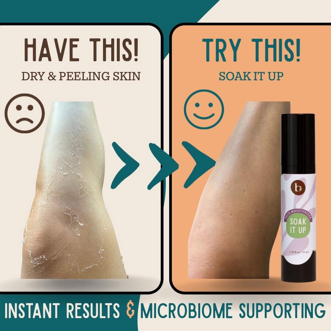 Soak It Up Dry Skin and Peeling Relief