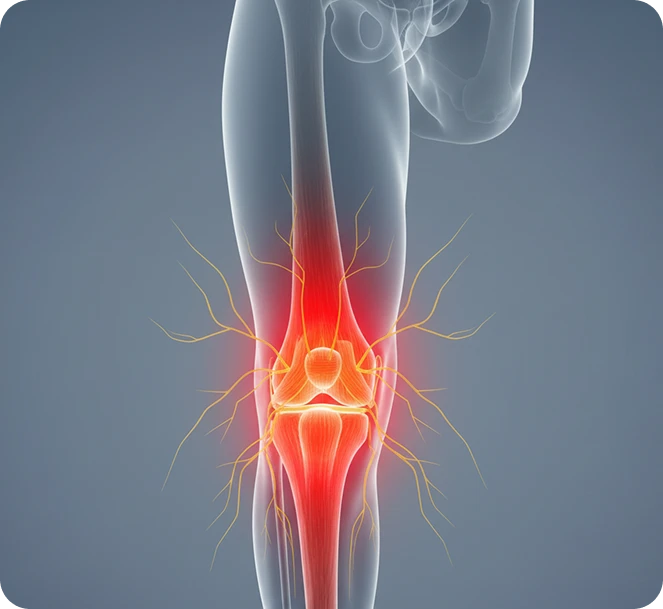 Soft Tissue and Ligament Damage