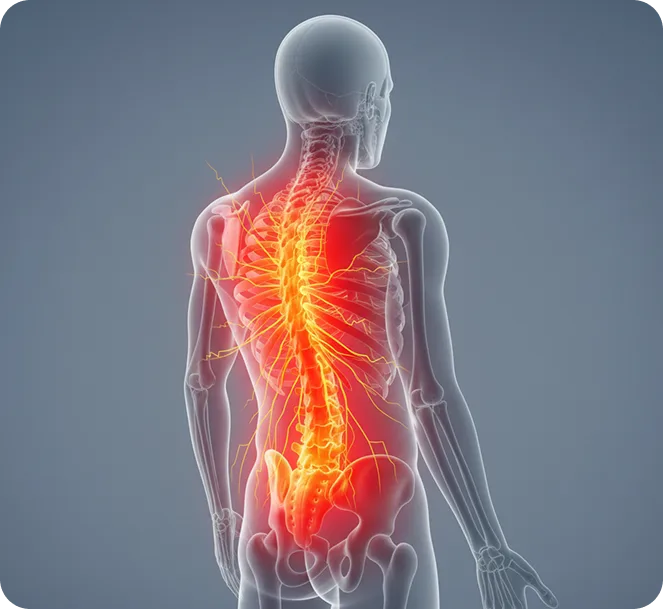 Spinal Cord and Nerve Irritation