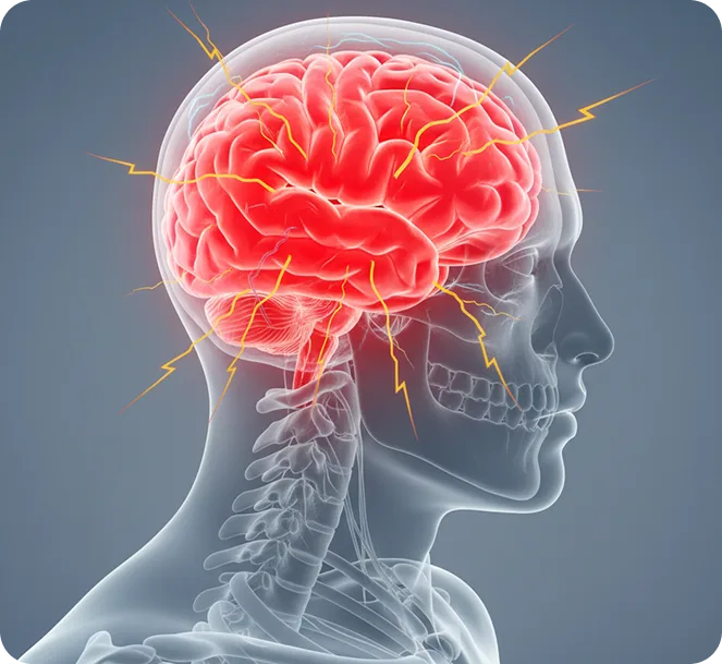 Headaches and Migraines After Impact