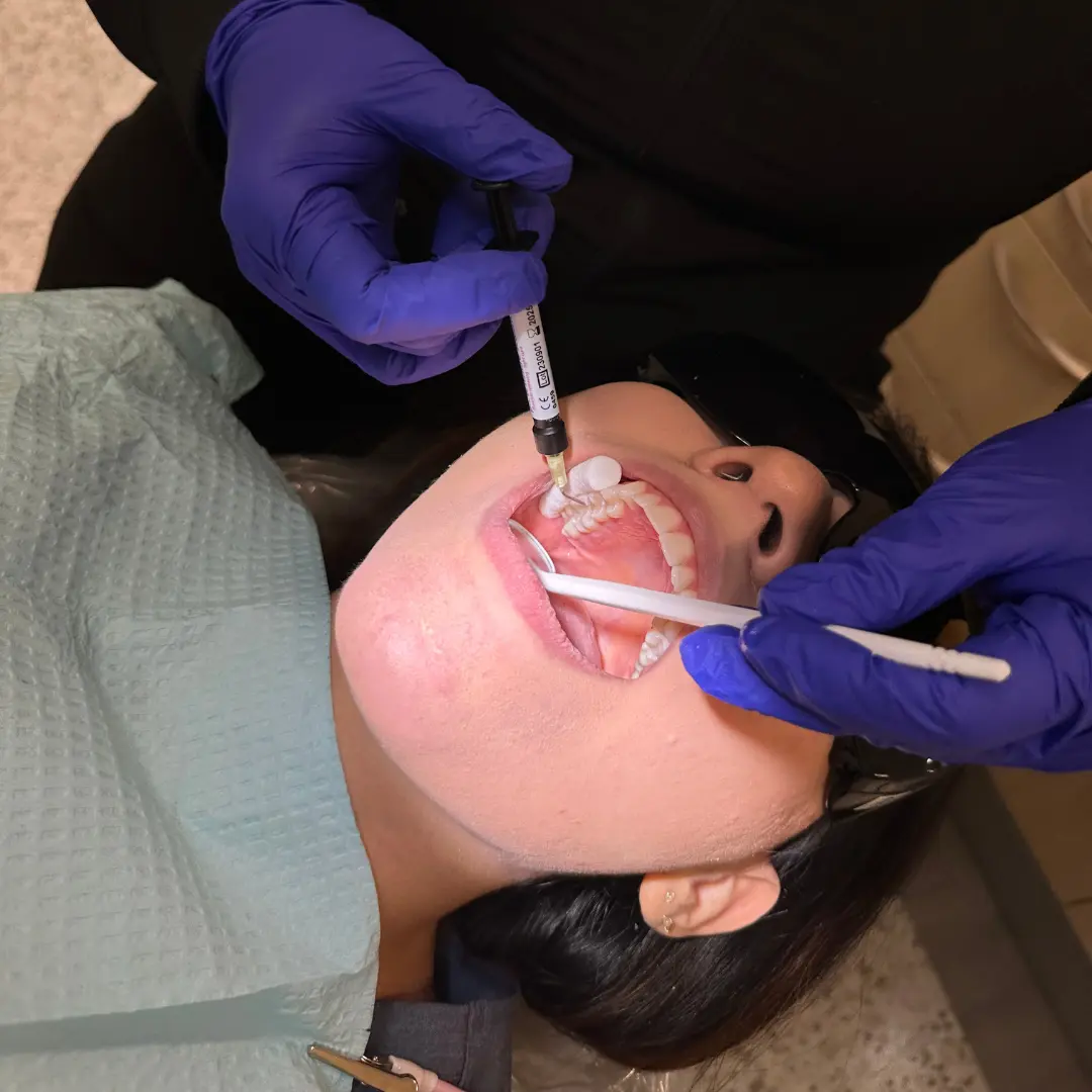 Illinois Pit and Fissure Sealants Course