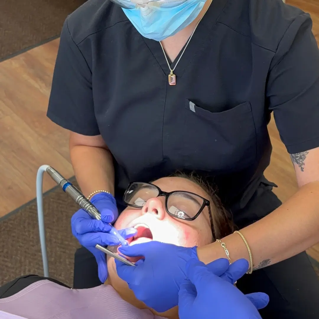 Indiana Coronal Polishing, Fluoride and Sealants Course
