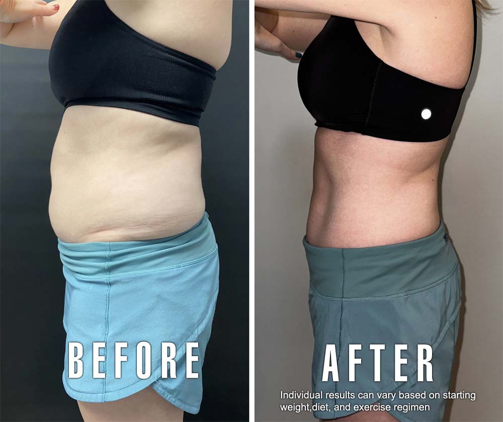 semaglutide two month results Lux Skin by John Lee, MD