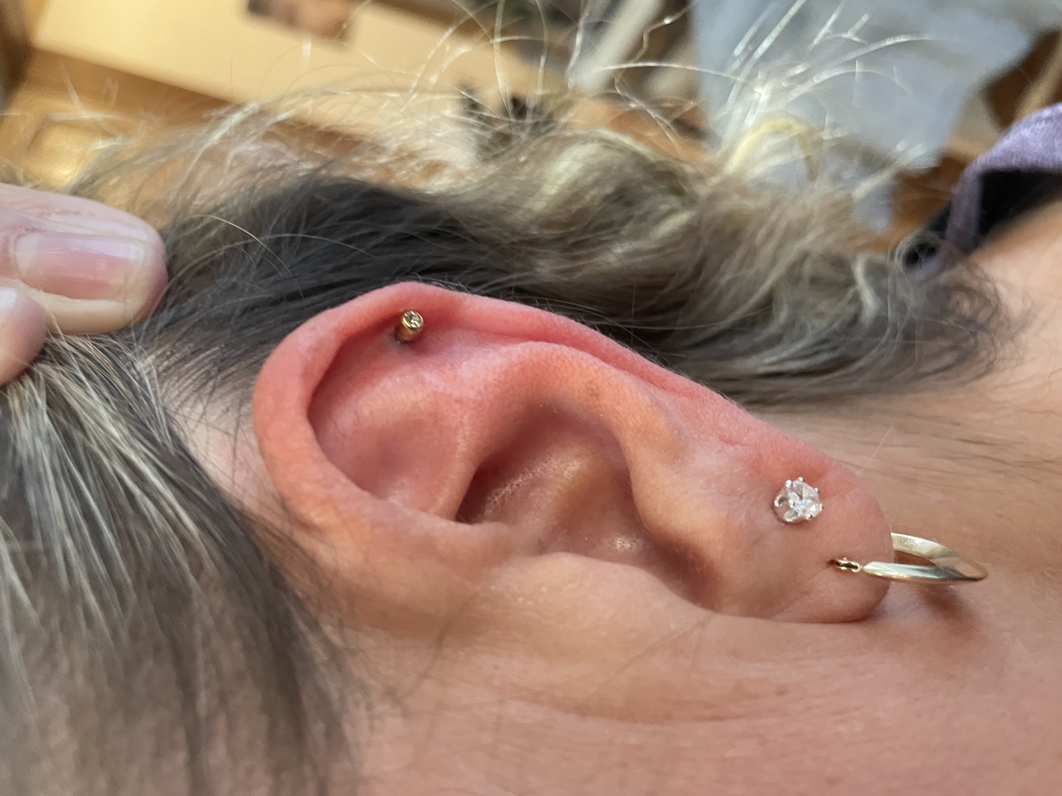 Medical Ear Piercing Medical Ear Piercing