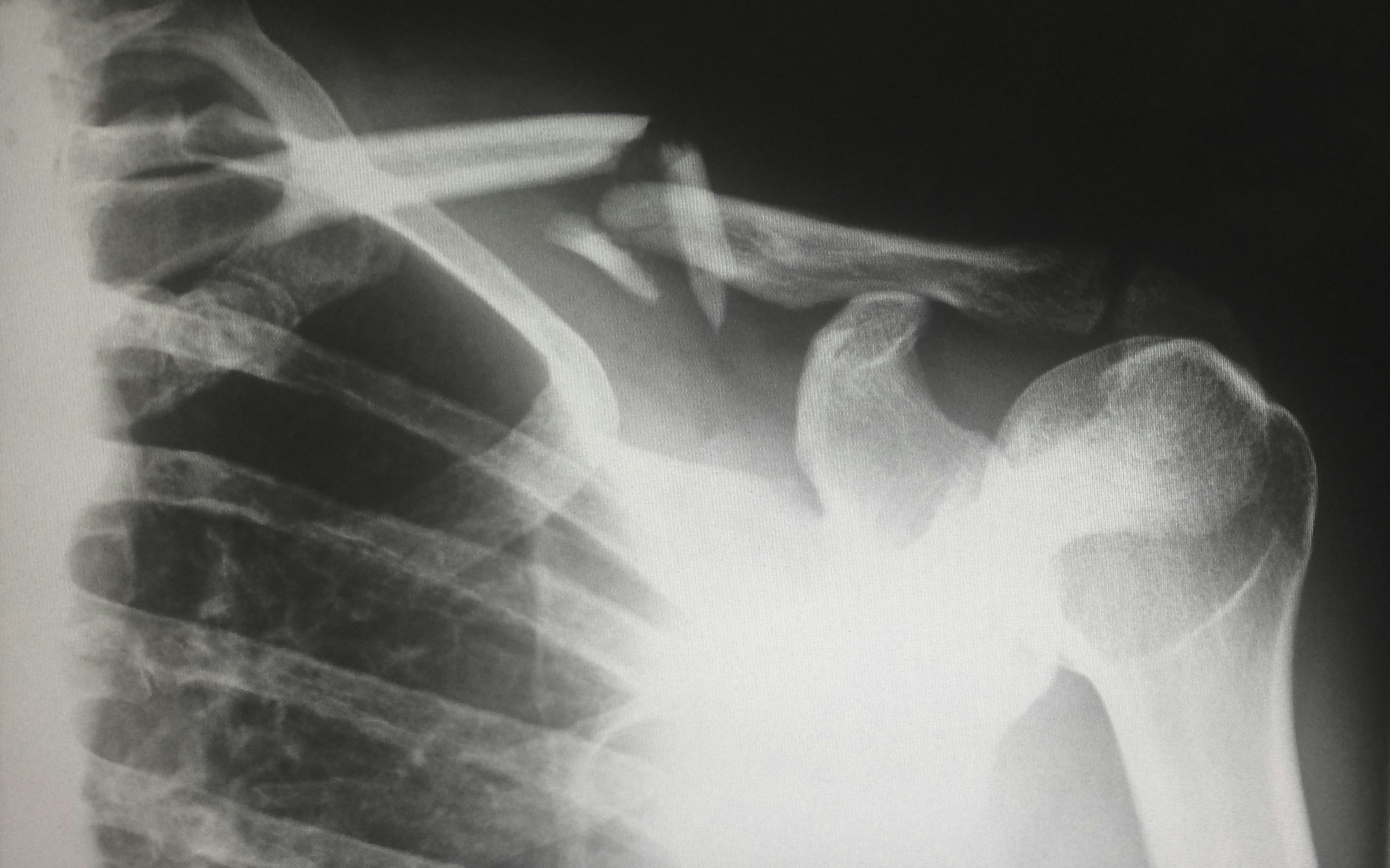 When to Worry About Shoulder Pain: Signs You Need Medical Attention When to Worry About Shoulder Pain: Signs You Need Medical Attention