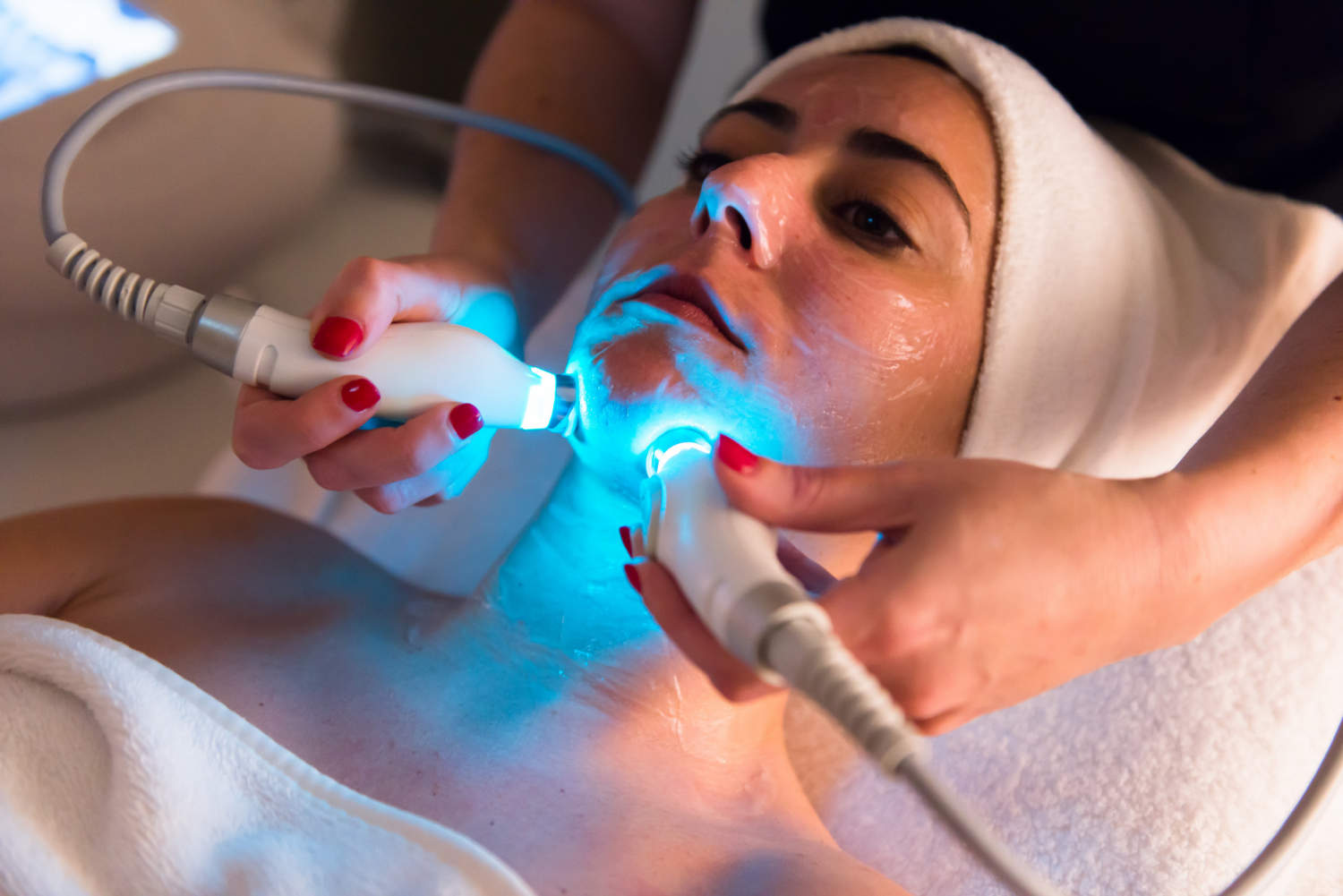 IPL Photofacial: Rejuvenating Your Skin's Radiance 