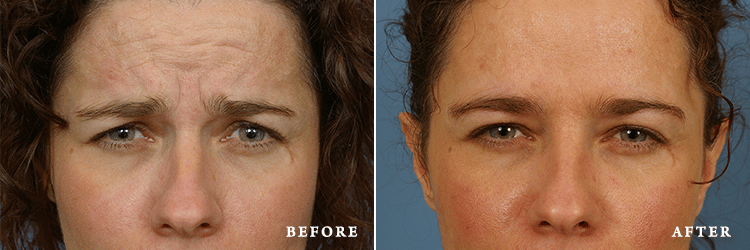 Vitamin D3 treatment image