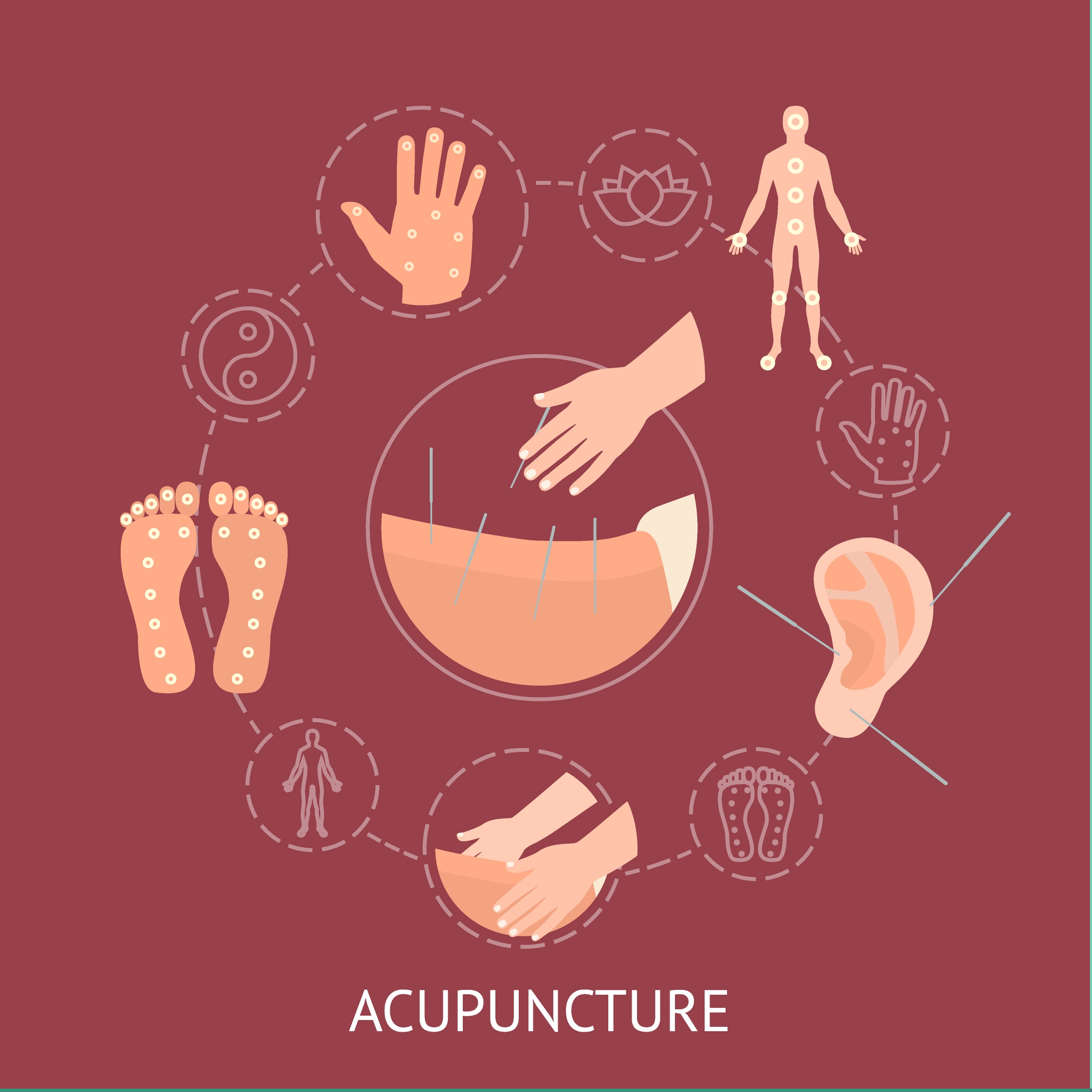 Top Acupuncture Specialists in Jersey City and Clifton @ New Jersey Rehab Experts Top Acupuncture Specialists in Jersey City and Clifton @ New Jersey Rehab Experts