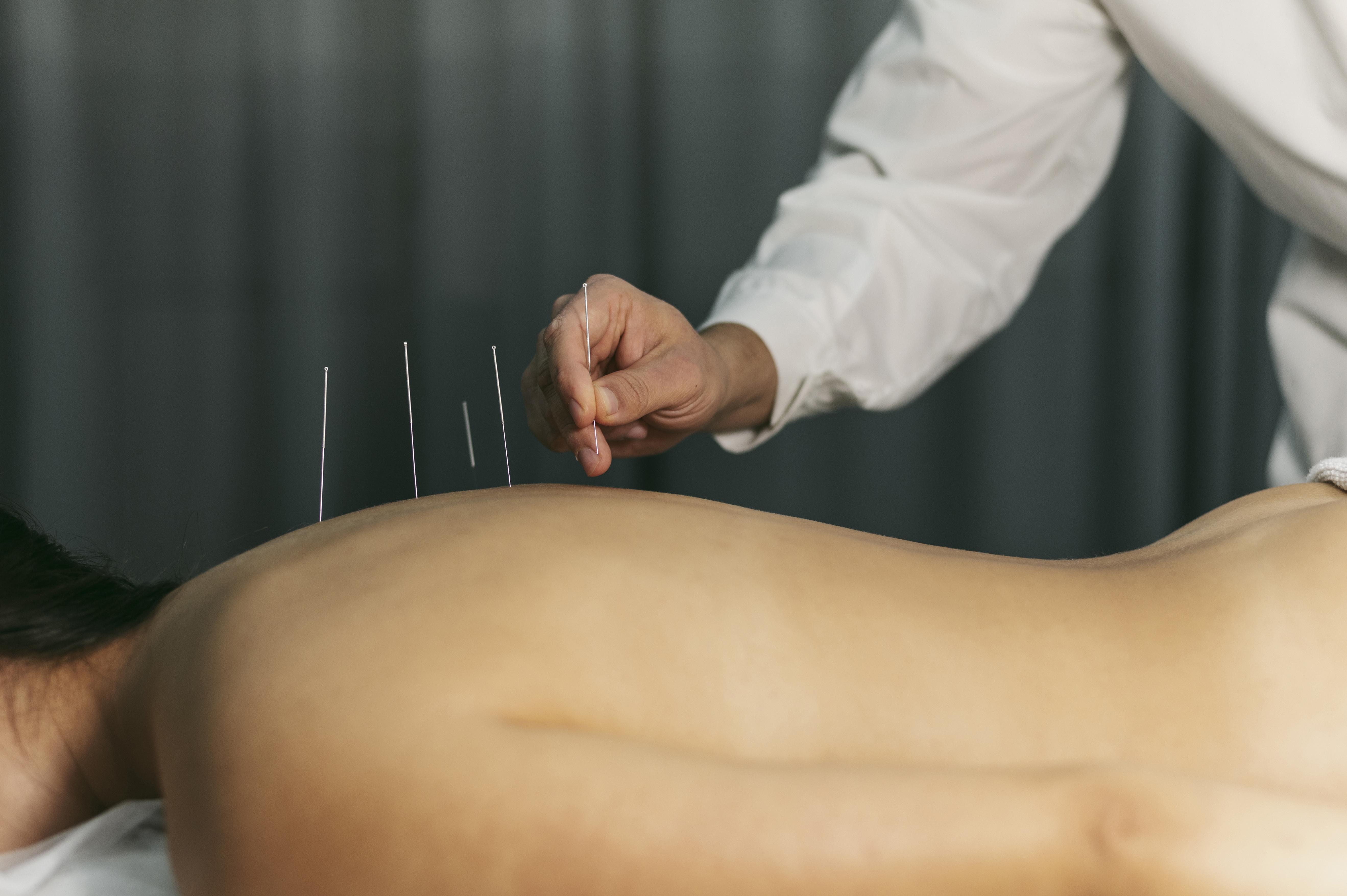 Top Acupuncture Specialists in Jersey City and Clifton @ New Jersey Rehab Experts Top Acupuncture Specialists in Jersey City and Clifton @ New Jersey Rehab Experts