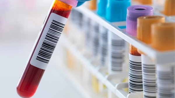 The cardio ion profile