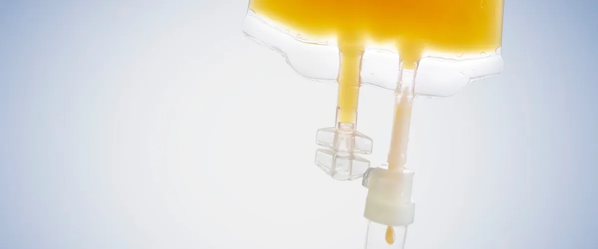 Nurse holding a clear IV bag filled with sliced fruits representing vitamin infusion therapy. Nurse holding a clear IV bag filled with sliced fruits representing vitamin infusion therapy.